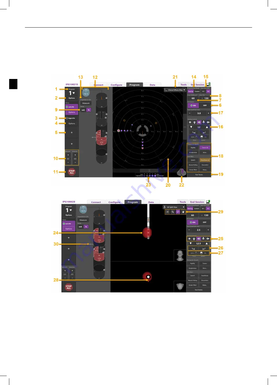 Boston Scientific Vercise Neural Navigator 4 Programming Manual Download Page 88