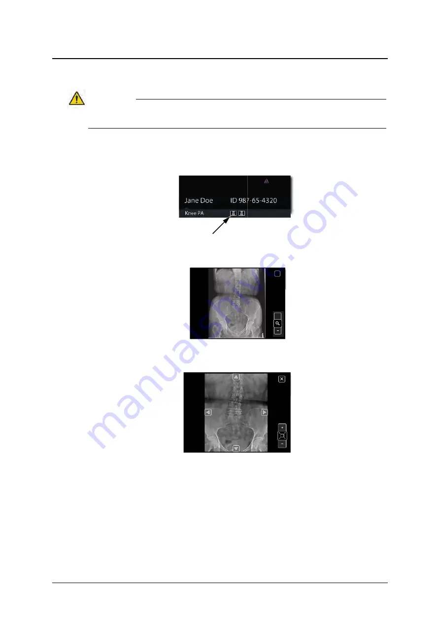 Canon OMNERA 400T Operator'S Manual Download Page 67