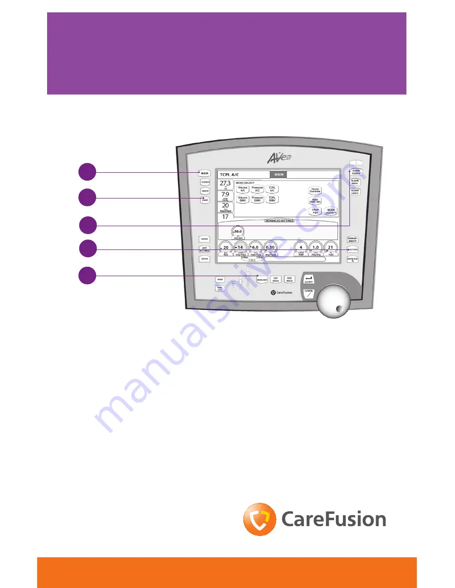 CareFusion AVEA Quick Tips Download Page 1