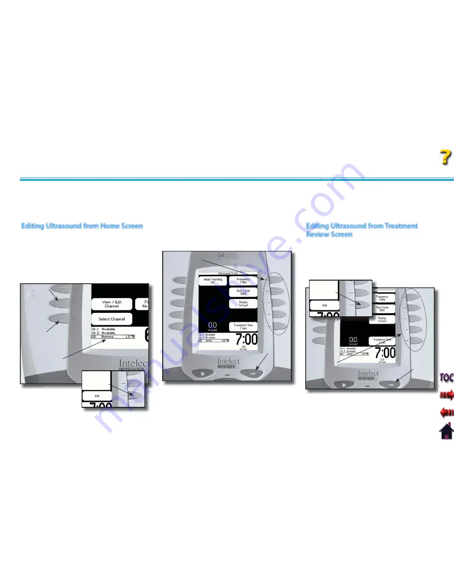 Chattanooga Group Intelect Legend XT 2760 Скачать руководство пользователя страница 48