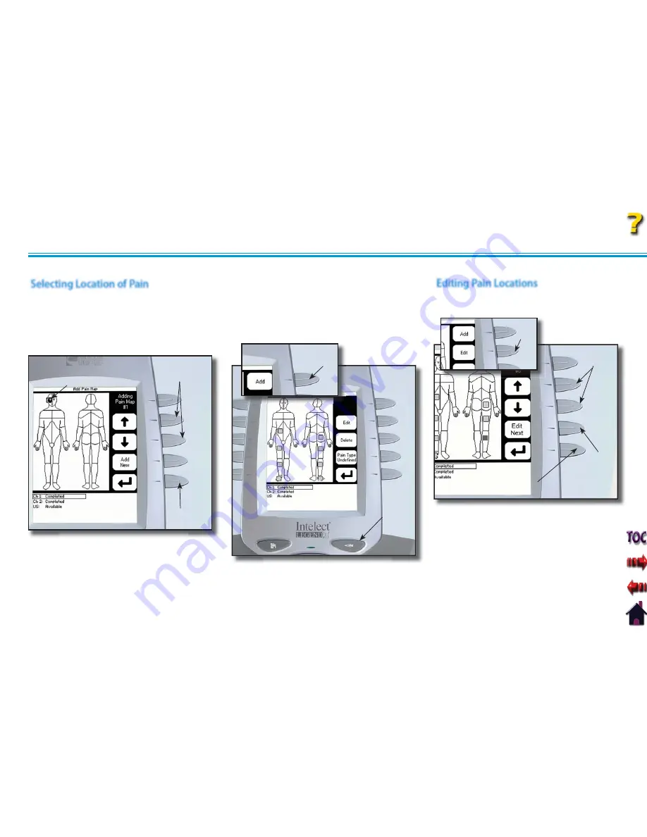 Chattanooga Group Intelect Legend XT 2760 Скачать руководство пользователя страница 58