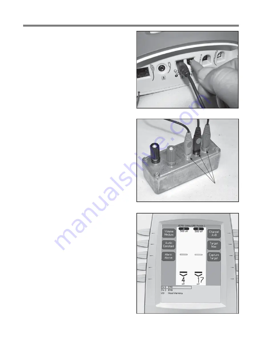 Chattanooga Group Intelect Legend XT Service Manual Download Page 59