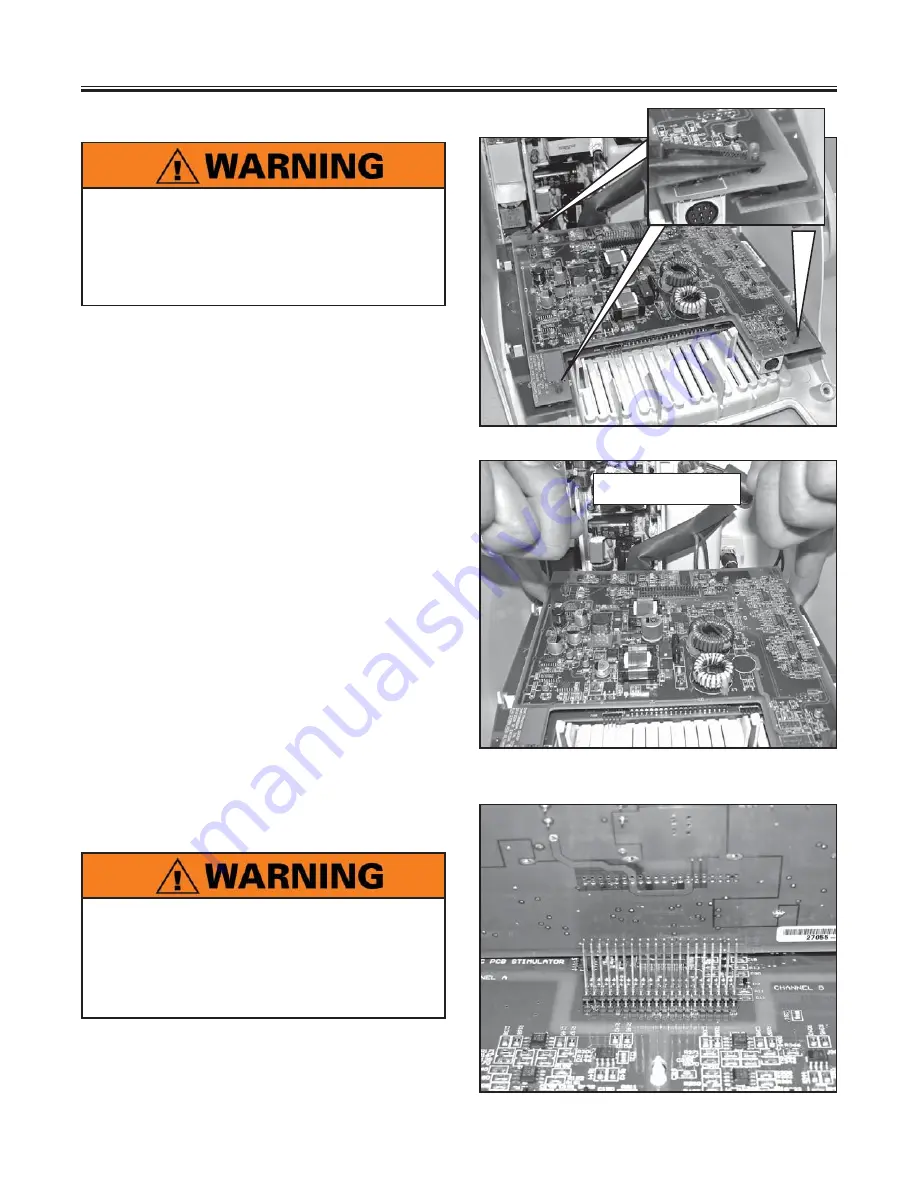 Chattanooga Group Intelect Legend XT Service Manual Download Page 77