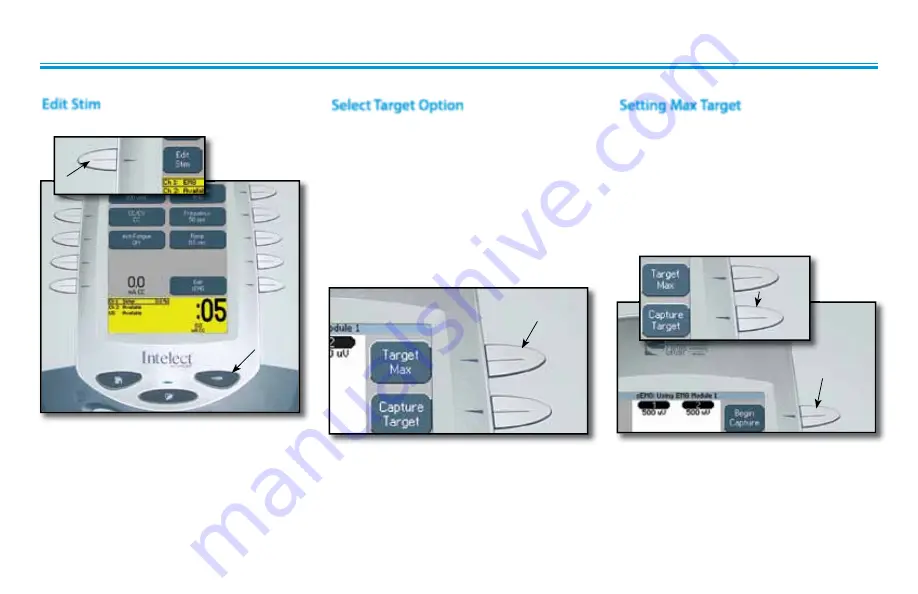 Chattanooga Intelect Advanced 2771 Скачать руководство пользователя страница 39