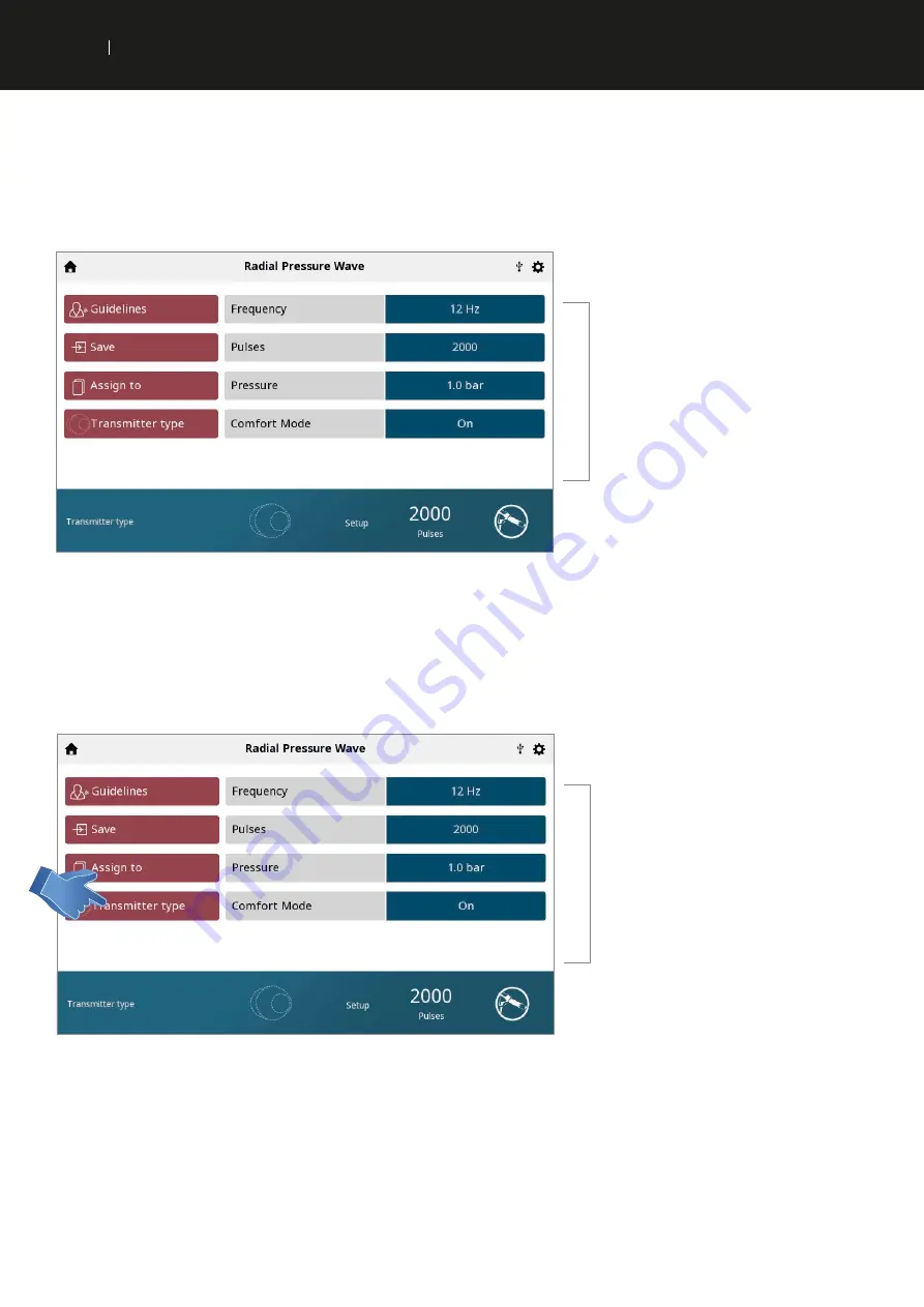 Chattanooga Intelect RPW 2 User Manual Download Page 34