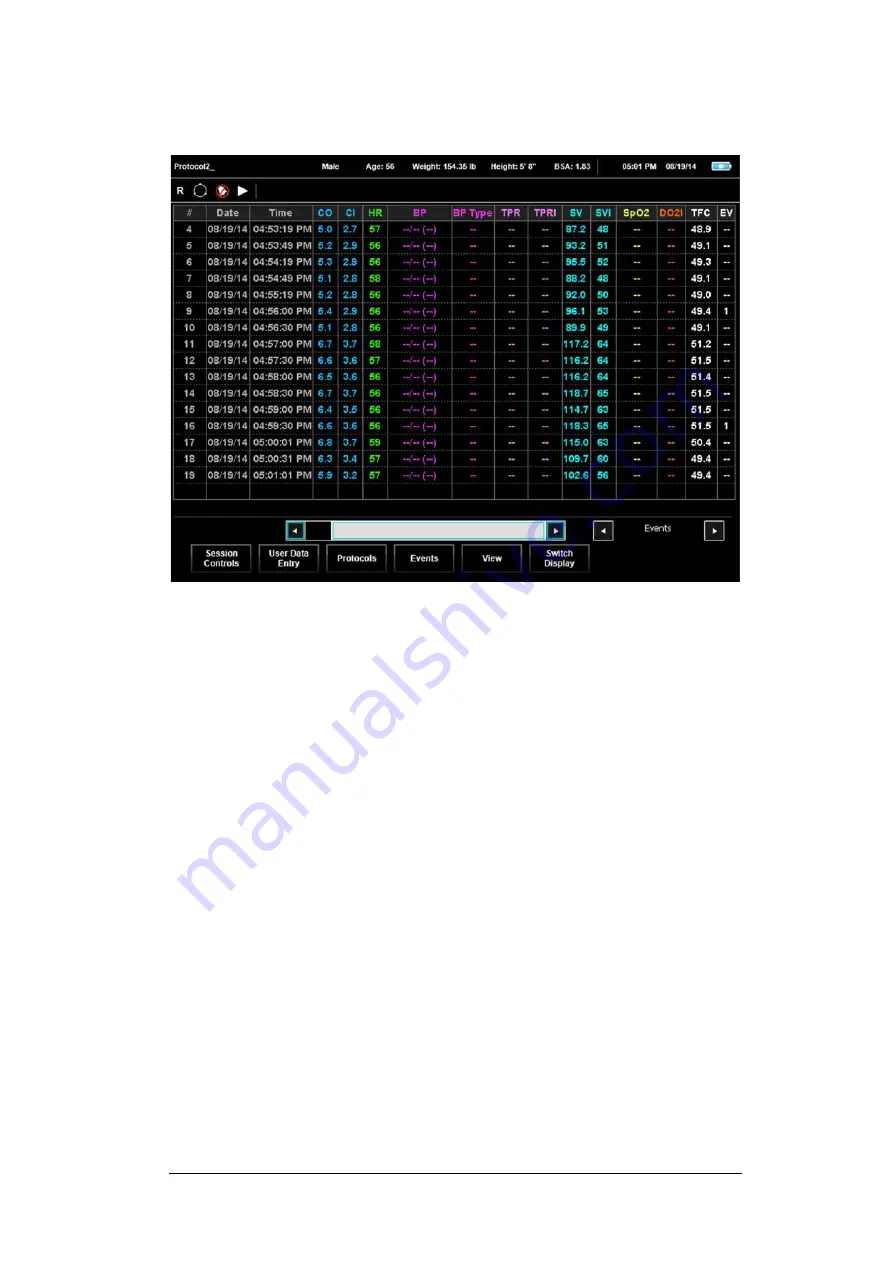 Cheetah Medical Starling SV User Manual Download Page 46