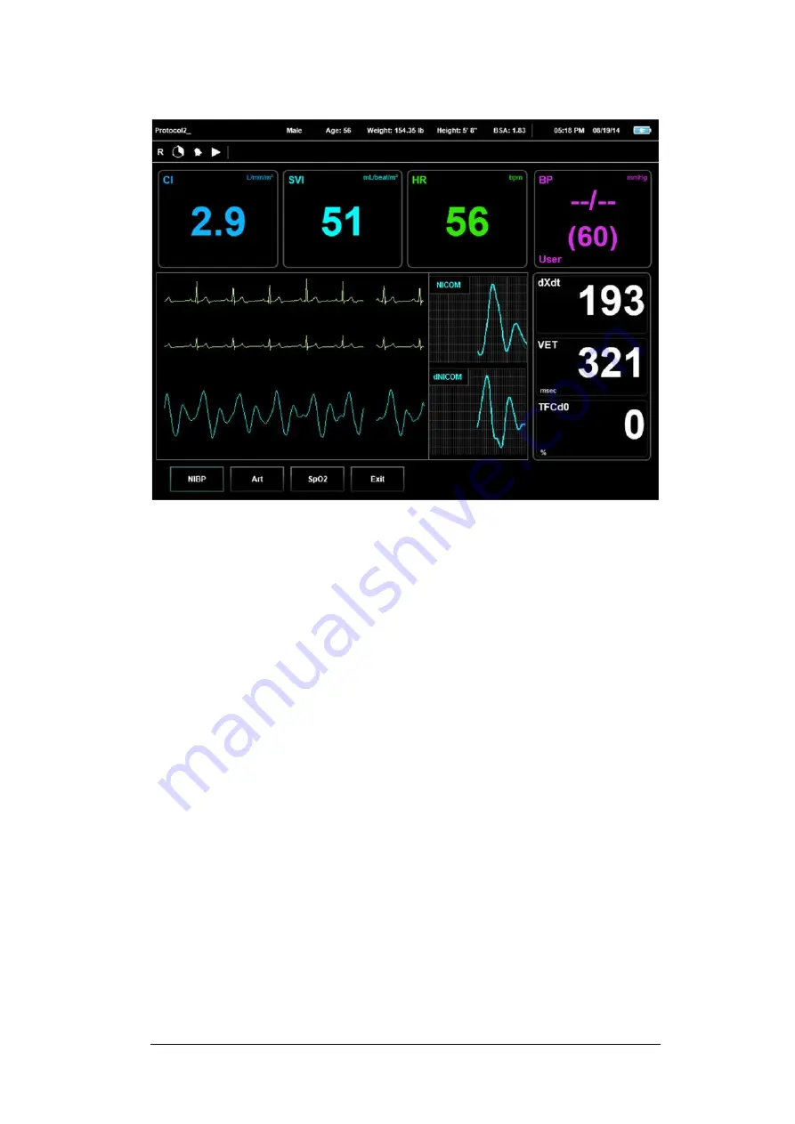 Cheetah Medical Starling SV Скачать руководство пользователя страница 48