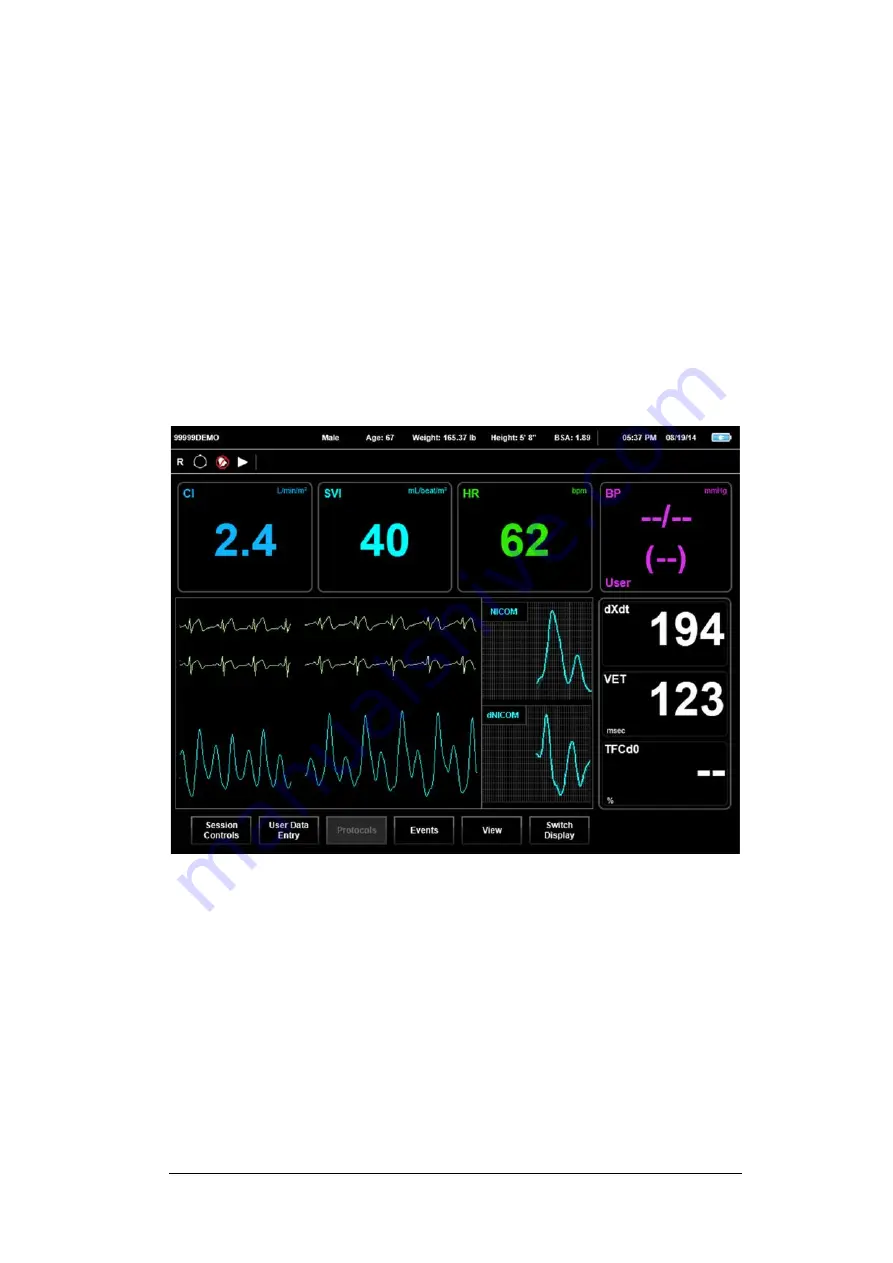 Cheetah Medical Starling SV Скачать руководство пользователя страница 62