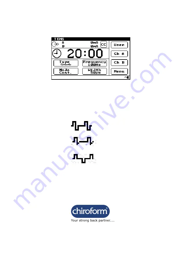 Chiroform 125 User Manual Download Page 32