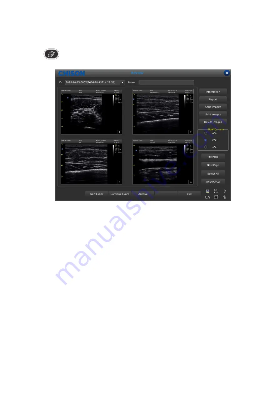 Chison ECO 6 Operation Manual Download Page 66