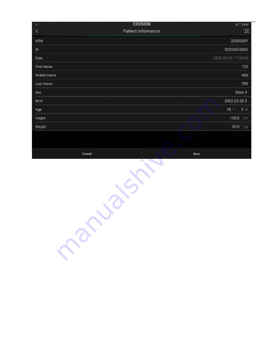 Chison SonoEye P2 User Manual Download Page 30