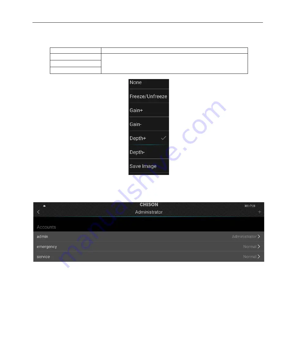 Chison SonoEye P3 User Manual Download Page 51