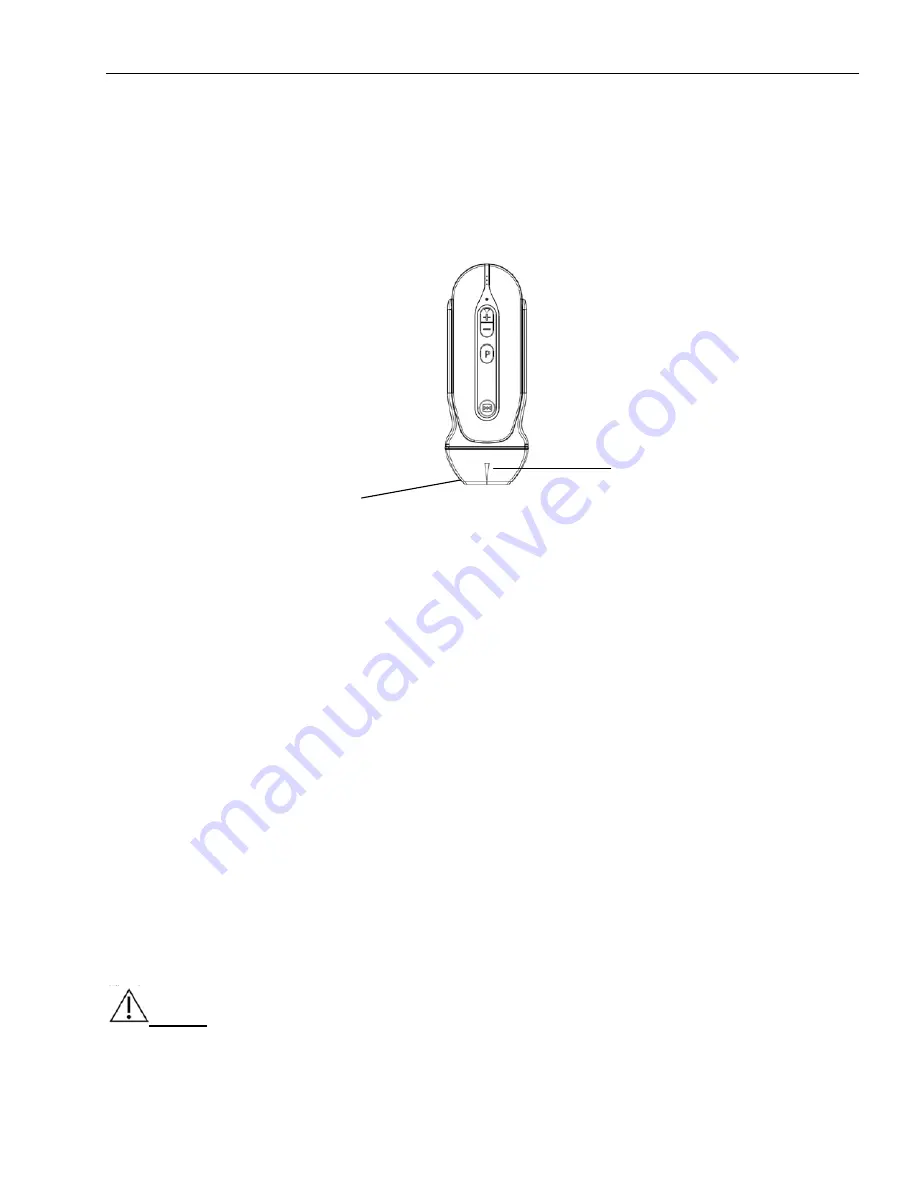 Chison SonoEye P3 User Manual Download Page 58