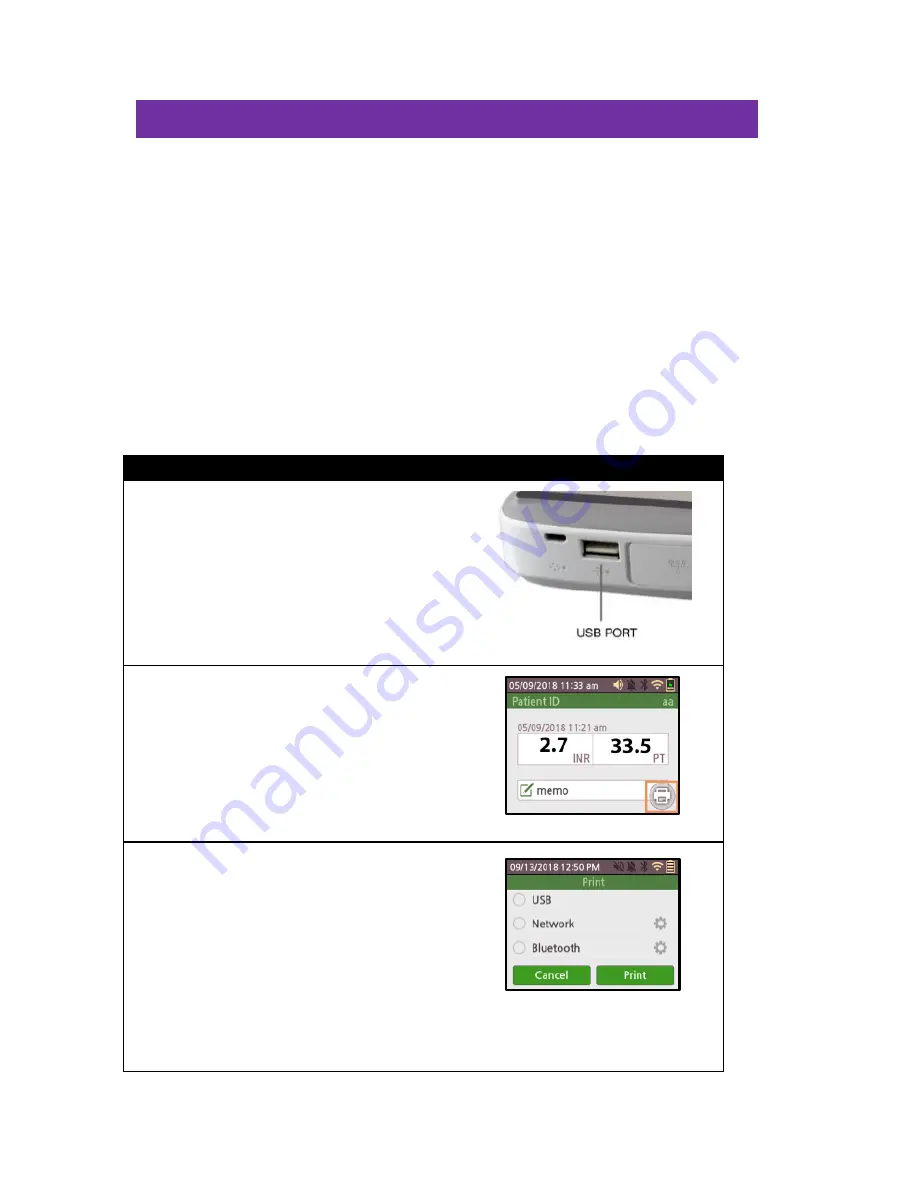 CoaguSense INR User Manual Download Page 46