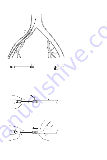 COOK Medical Zilver Instructions For Use Manual Download Page 3