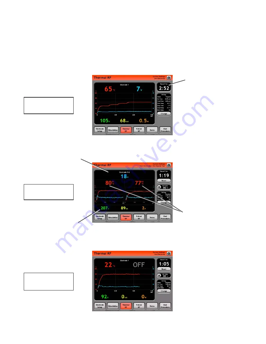 Cosman G4 Service Manual Download Page 30