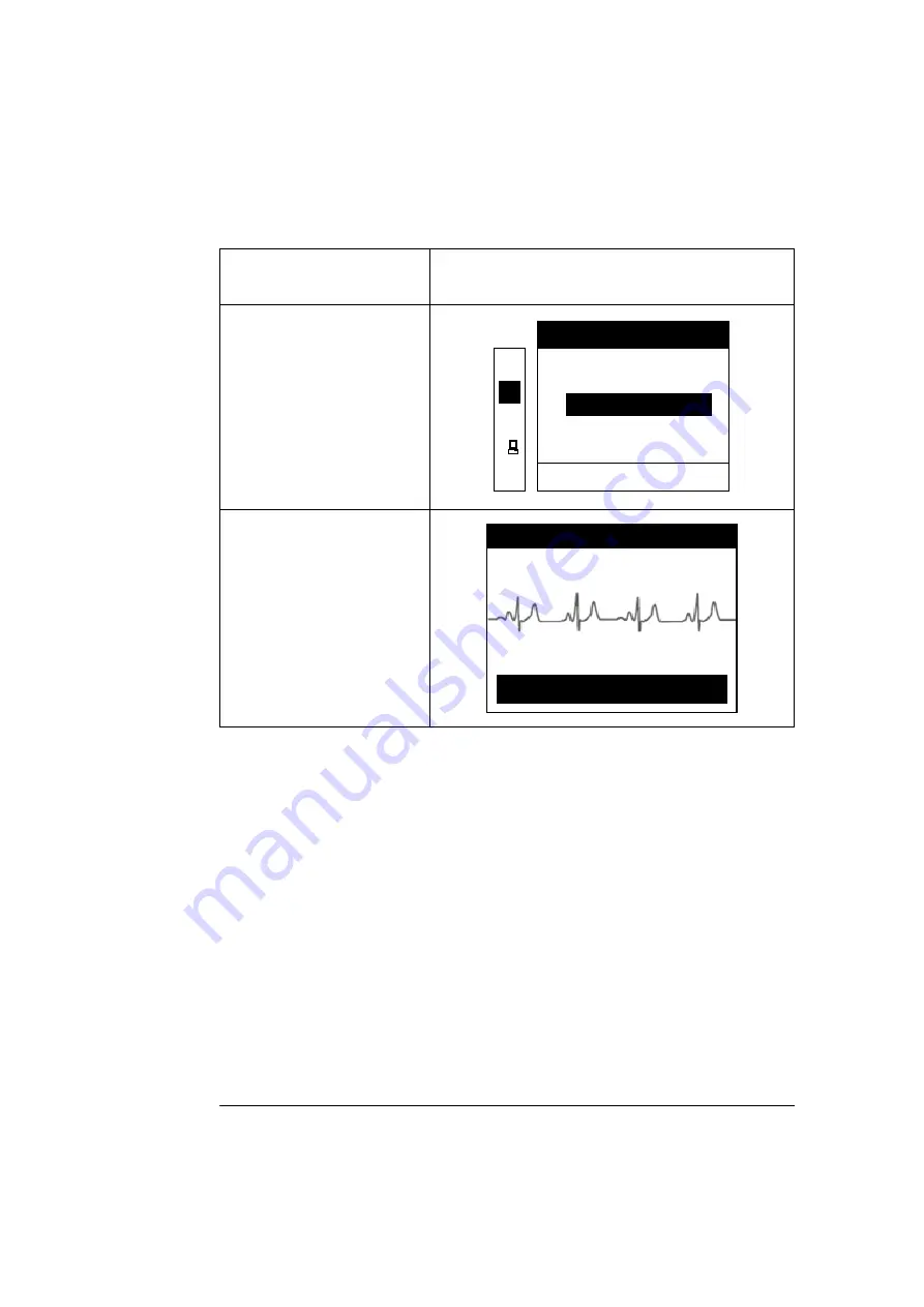 CU Medical Systems Paramedic CU-ER1 Operator'S Manual Download Page 39