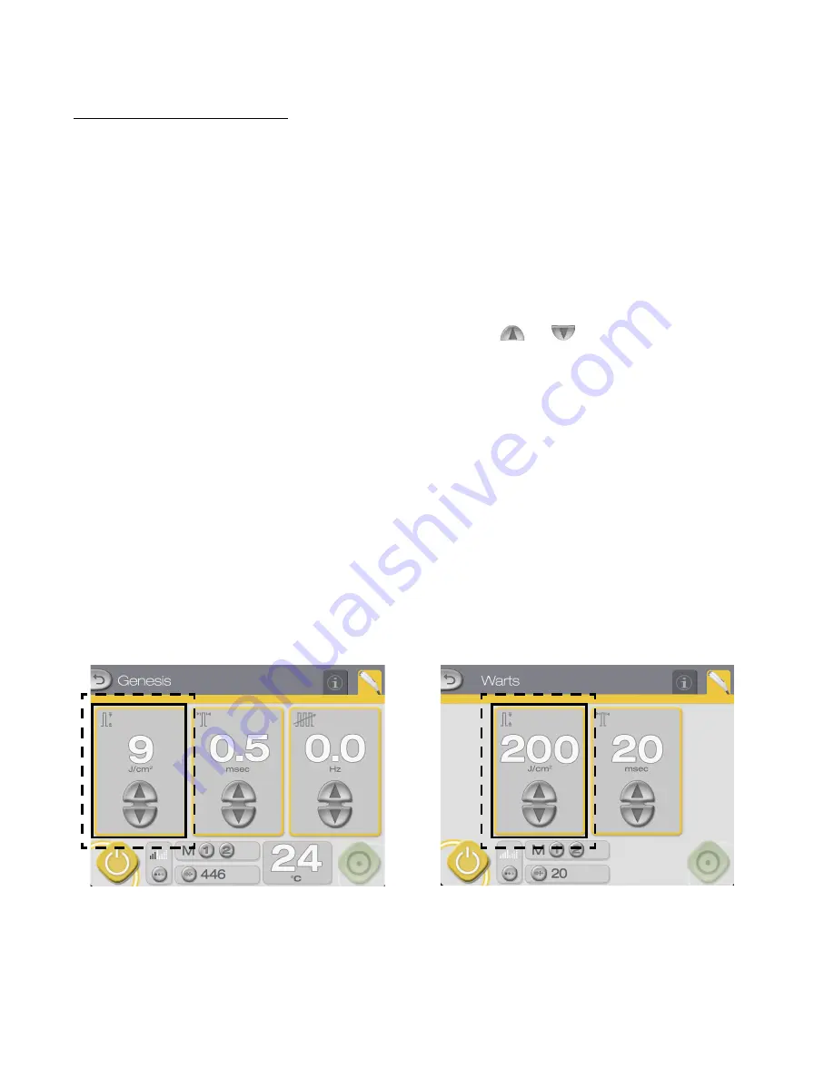 Cutera GenesisPlus Operator'S Manual Download Page 30