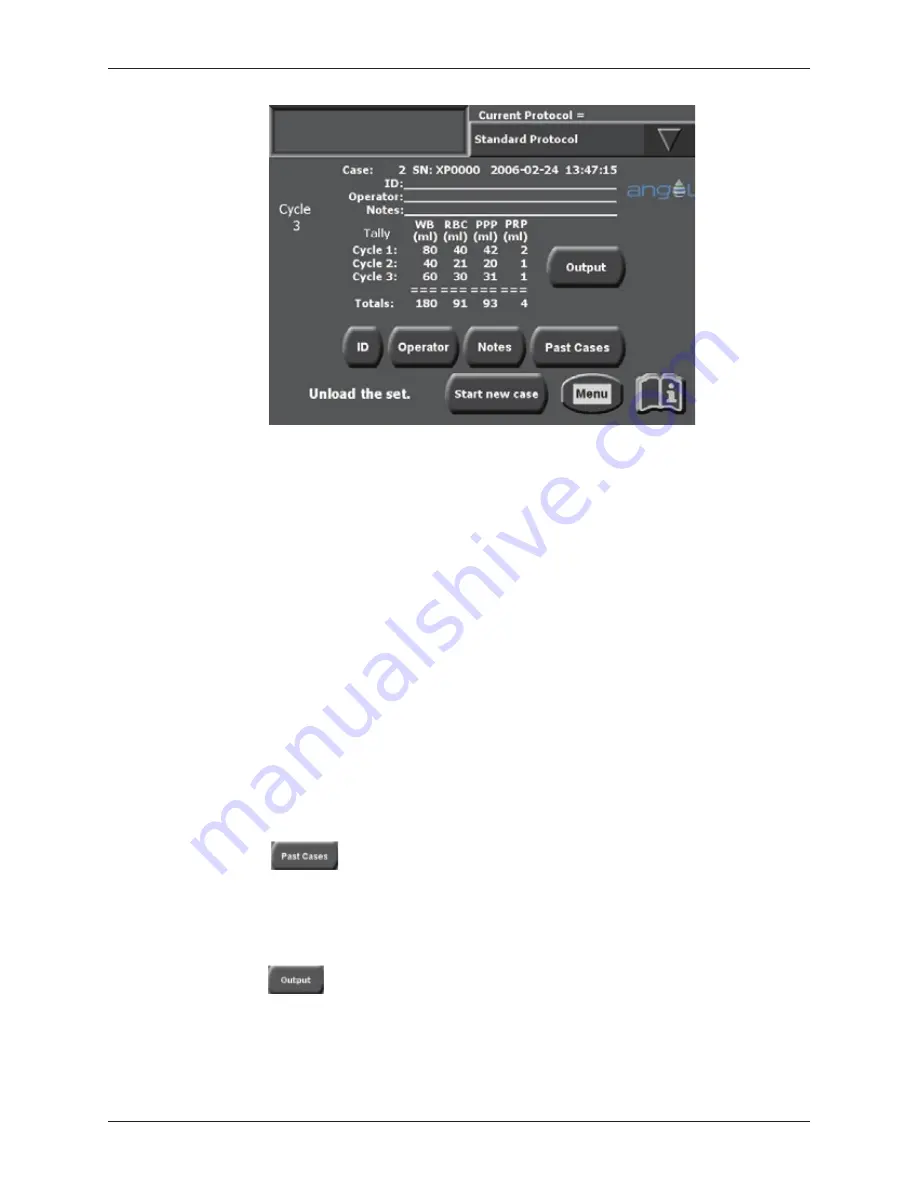 Cytomedix Angel Operator'S Manual Download Page 44