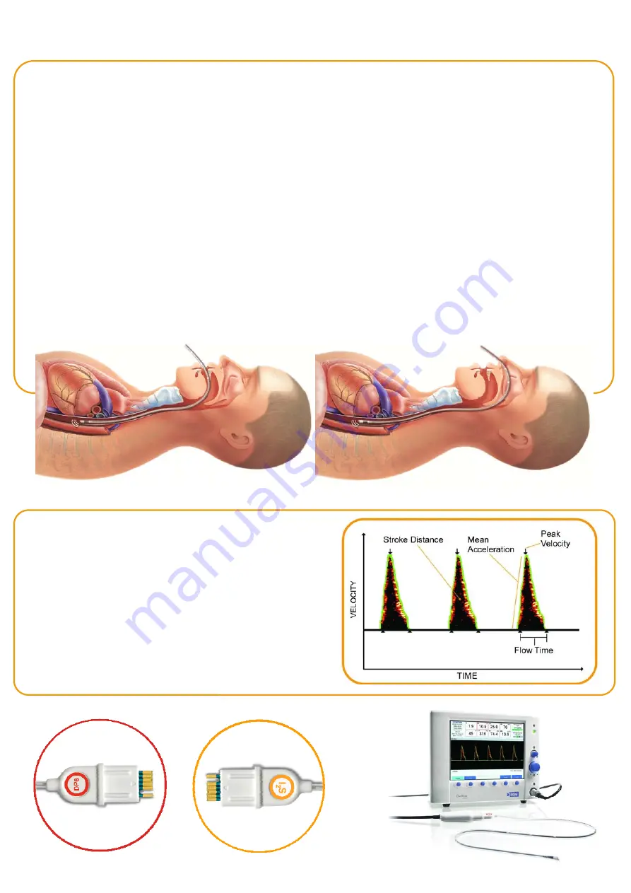 Deltex Medical CardioQ-ODM Скачать руководство пользователя страница 1