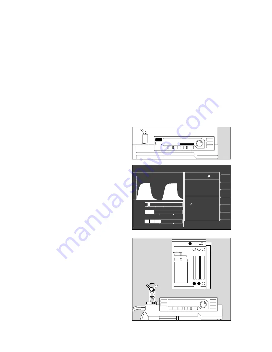 Dräger Cato Instructions For Use Manual Download Page 36