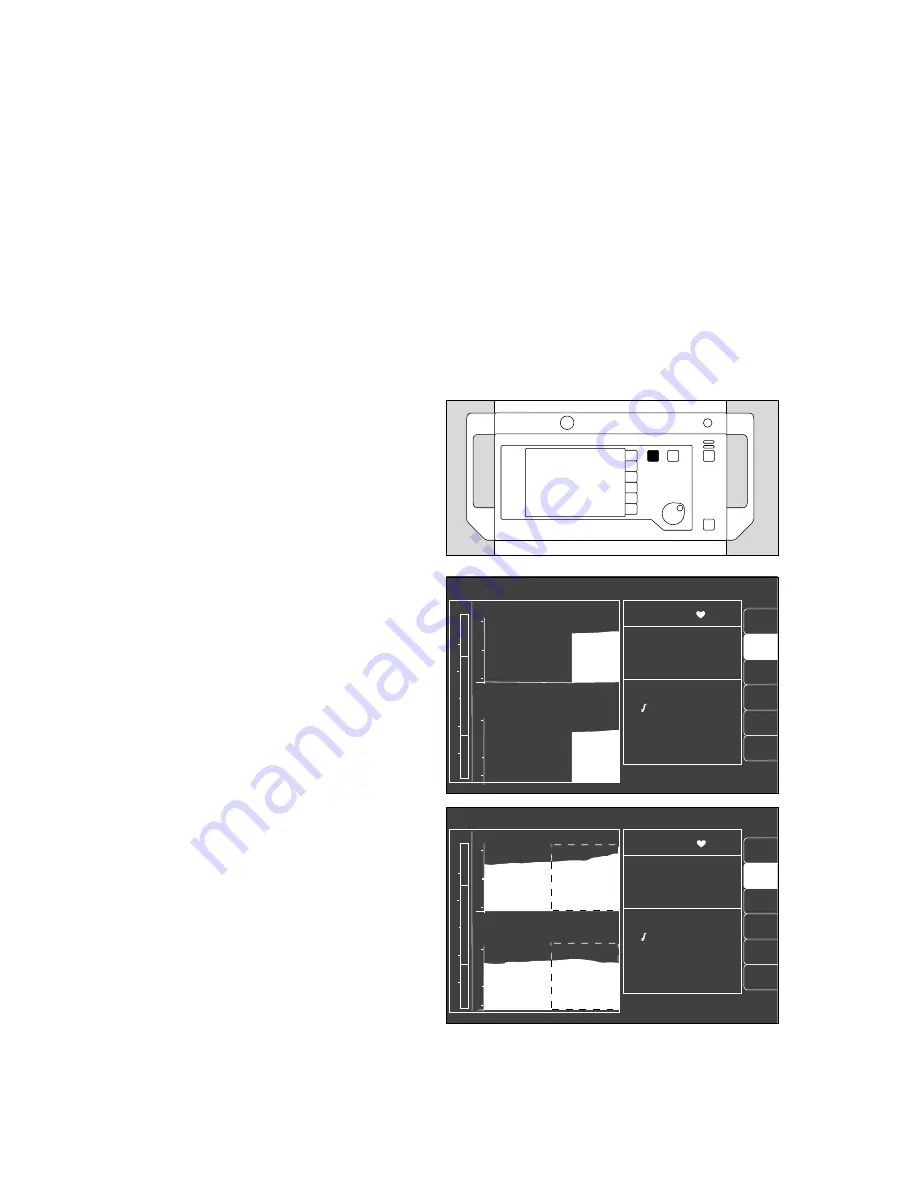 Dräger Cato Instructions For Use Manual Download Page 58