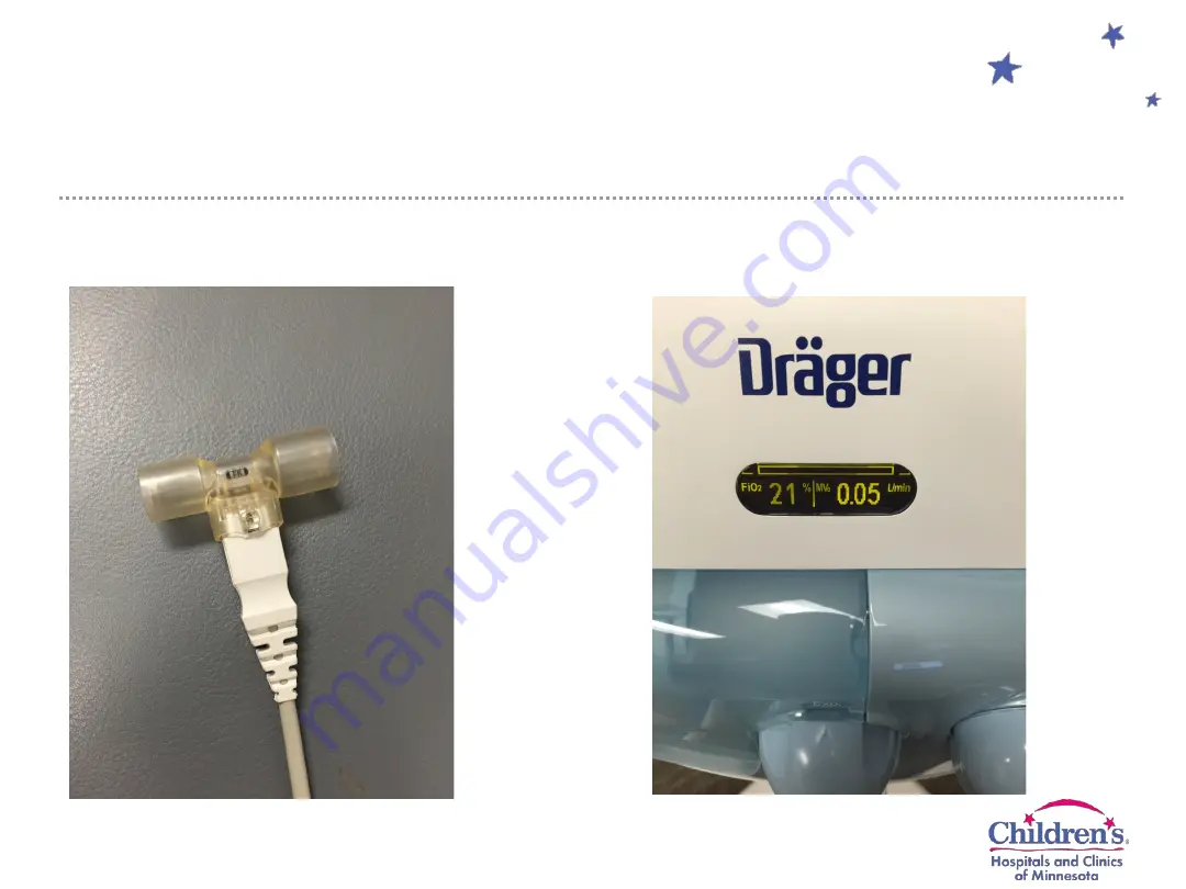 Dräger Infinity Acute Care System Evita Infinity V500 Скачать руководство пользователя страница 4