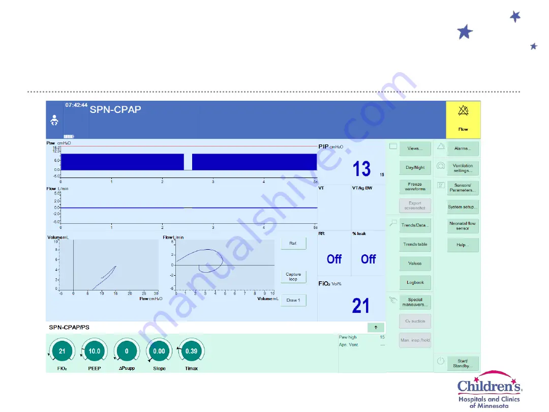 Dräger Infinity Acute Care System Evita Infinity V500 Скачать руководство пользователя страница 19