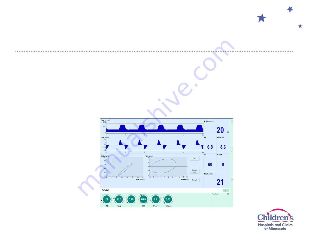 Dräger Infinity Acute Care System Evita Infinity V500 Скачать руководство пользователя страница 25