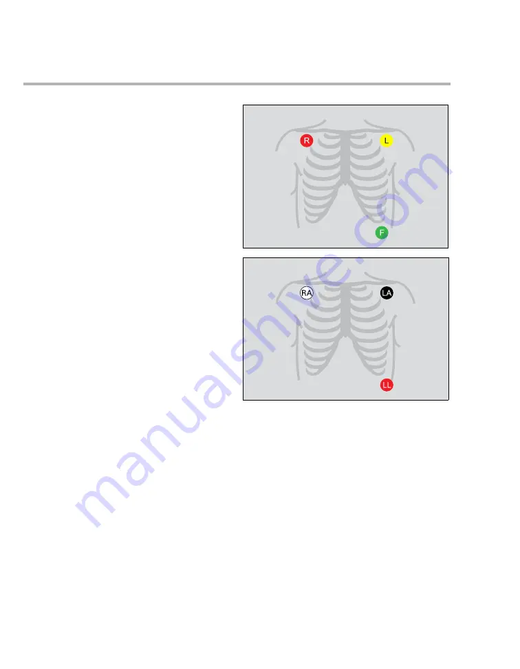 Dräger Infinity Acute Care System M540 Instructions For Use Manual Download Page 244