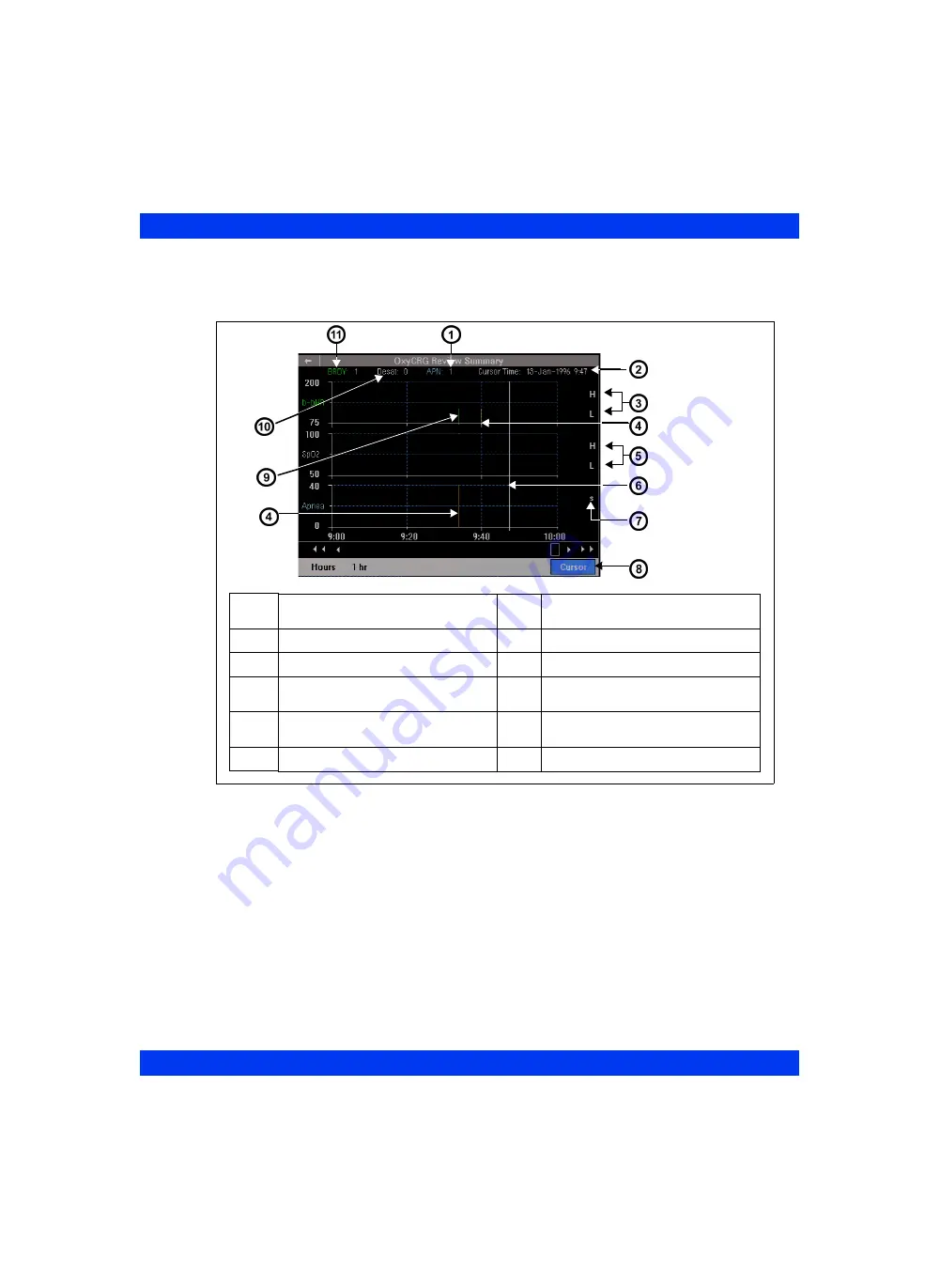 Dräger Infinity Delta Instructions For Use Manual Download Page 211