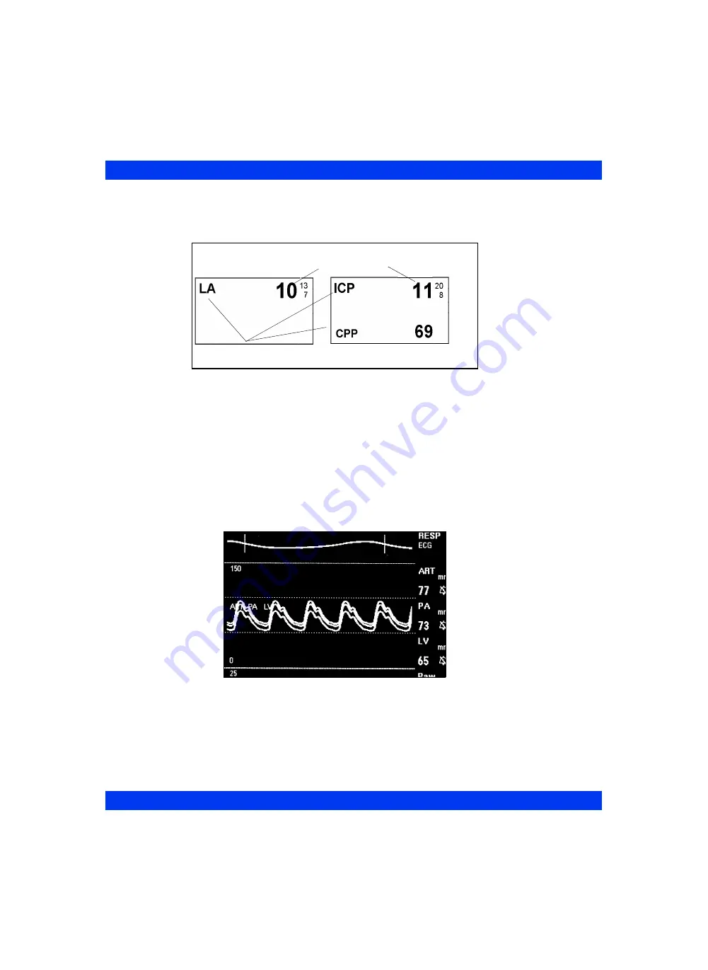 Dräger Infinity Delta Instructions For Use Manual Download Page 246