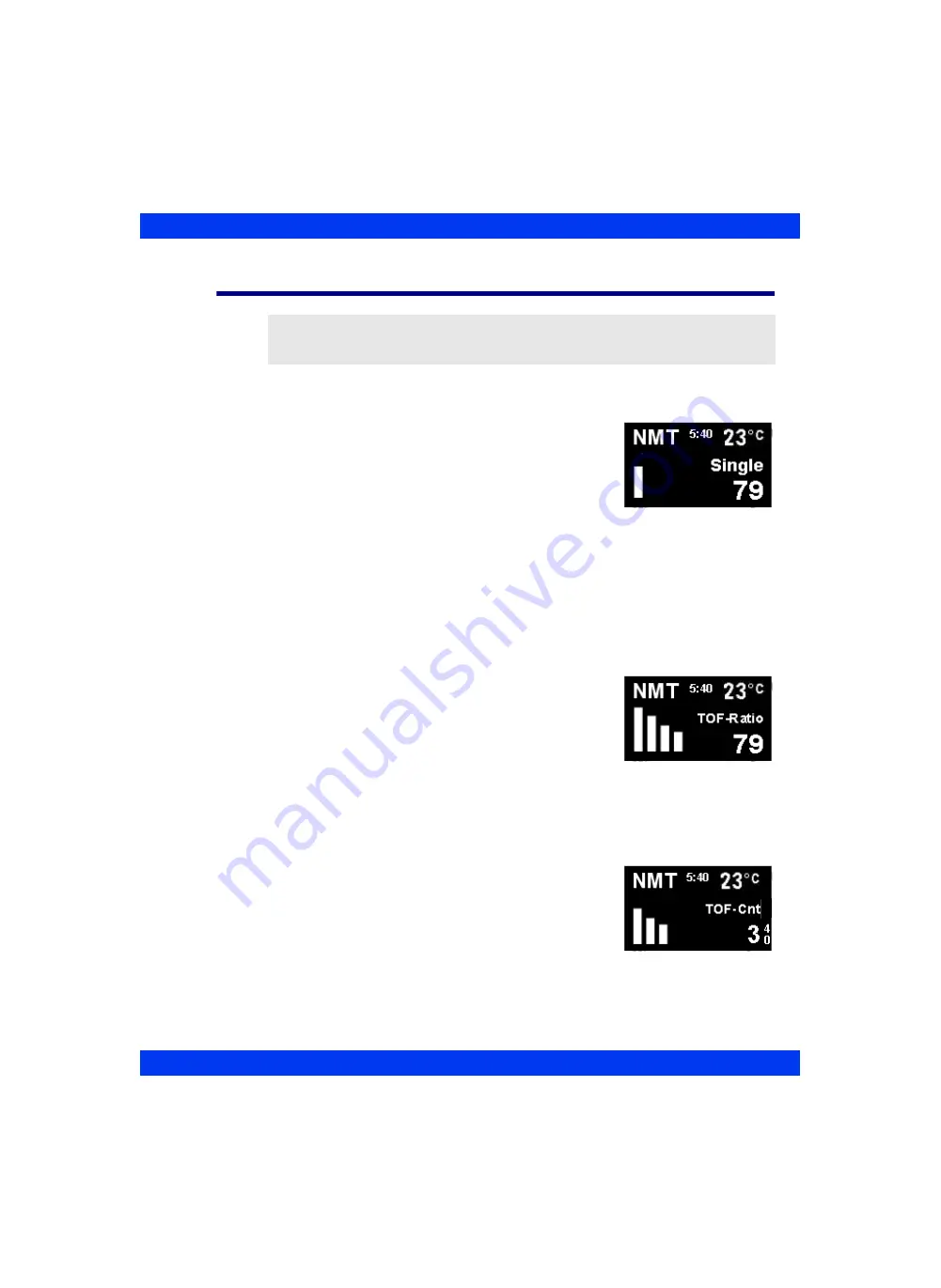 Dräger Infinity Delta Instructions For Use Manual Download Page 423