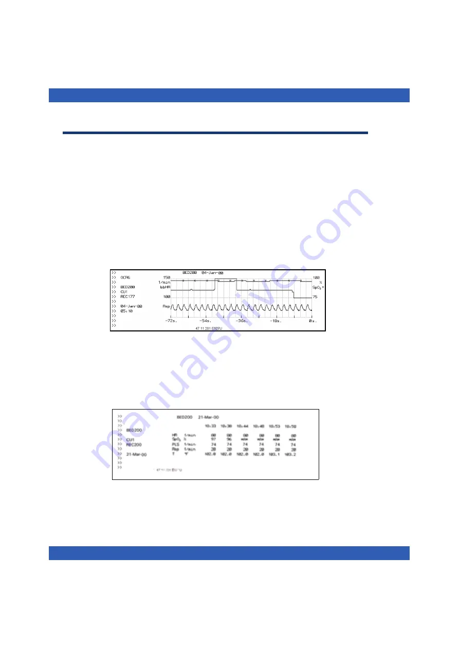 Dräger Infinity Vista Instructions For Use Manual Download Page 124