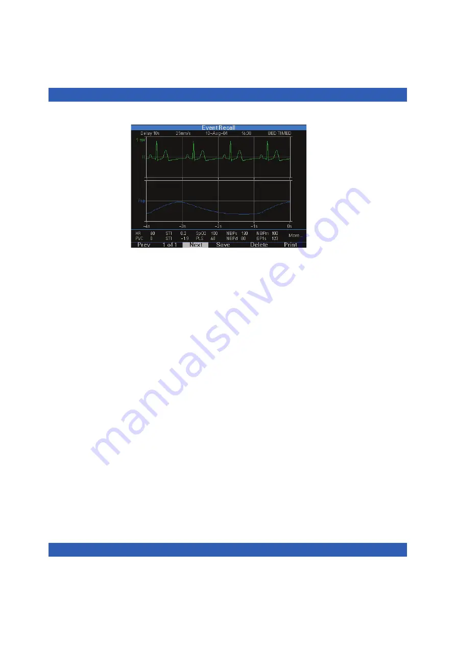 Dräger Infinity Vista Instructions For Use Manual Download Page 128