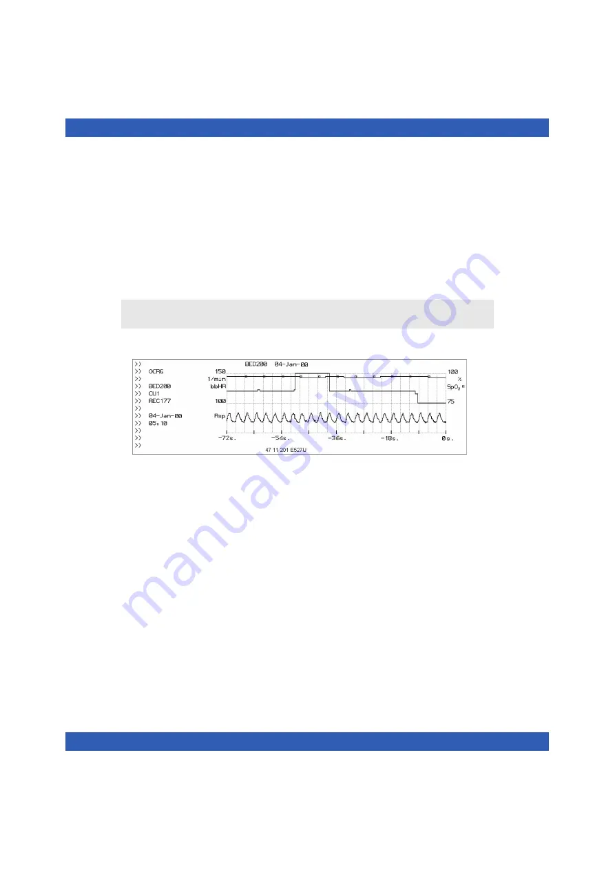 Dräger Infinity Vista Instructions For Use Manual Download Page 180