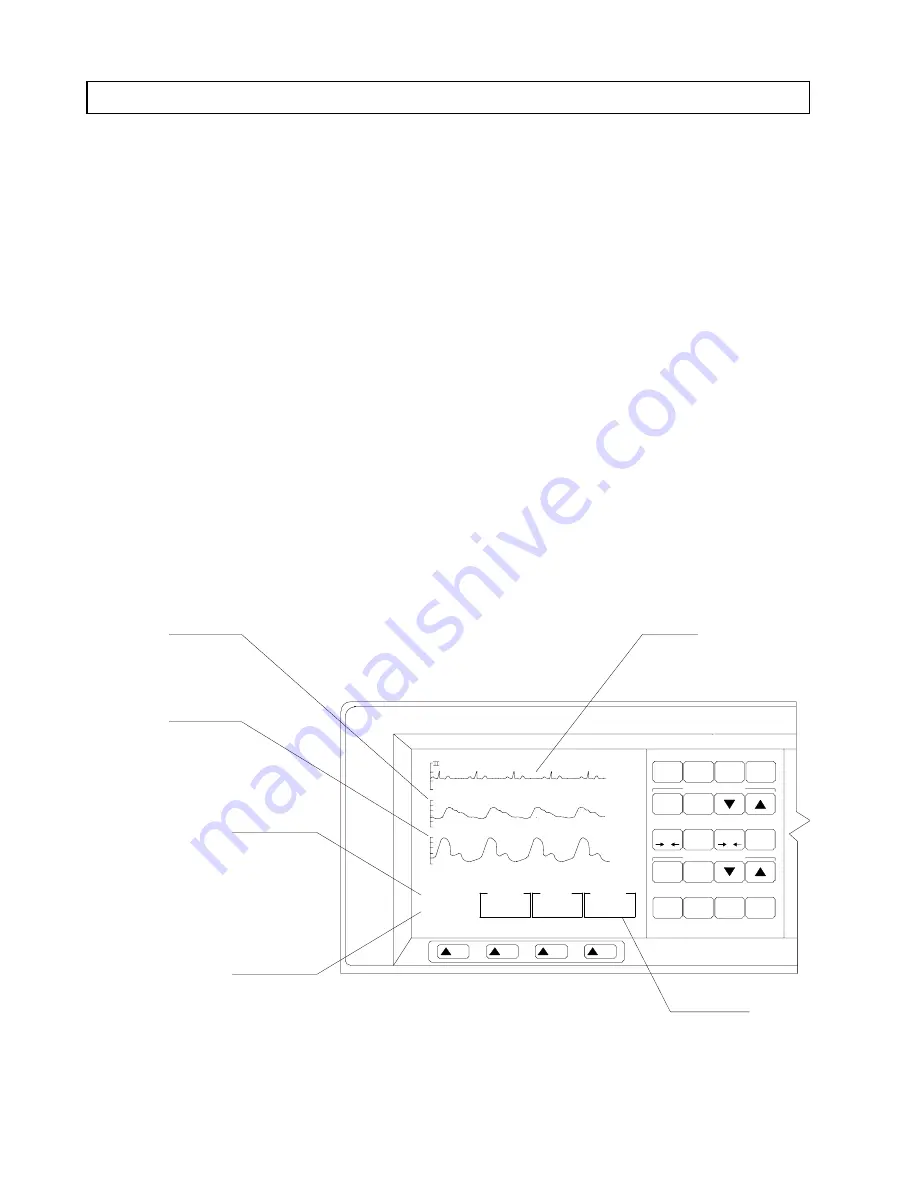 Dräger VITALERT 2000 Operator'S Instruction Manual Download Page 12