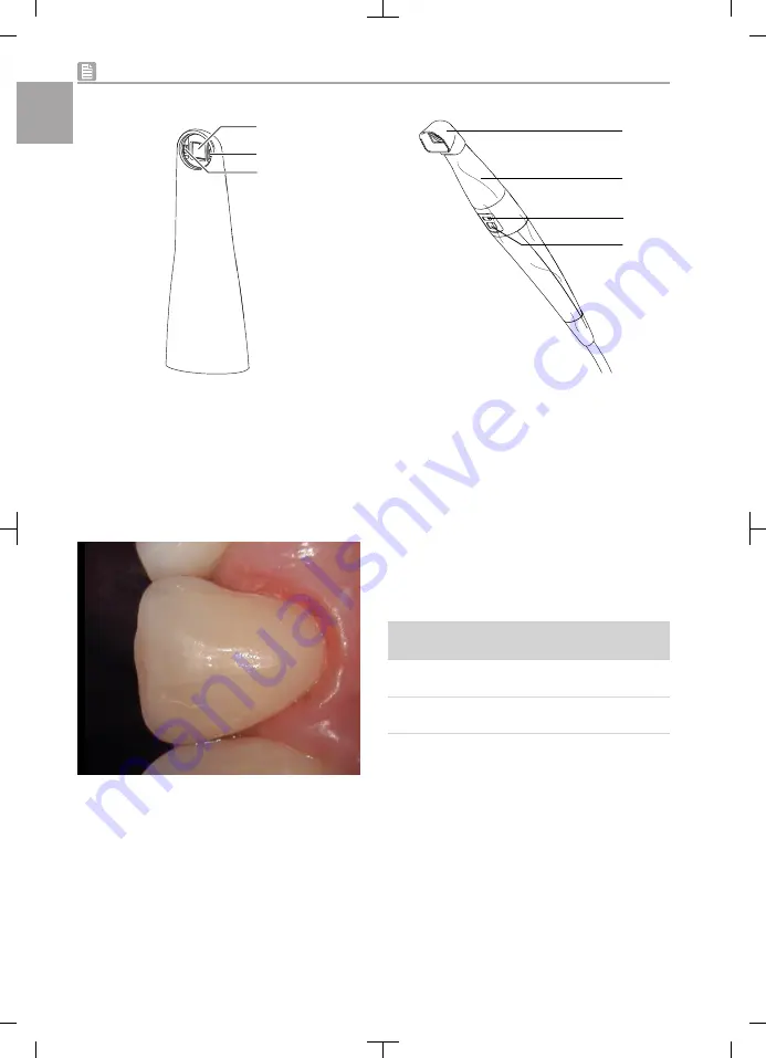 Durr Dental VistaCam iX HD Smart Скачать руководство пользователя страница 16