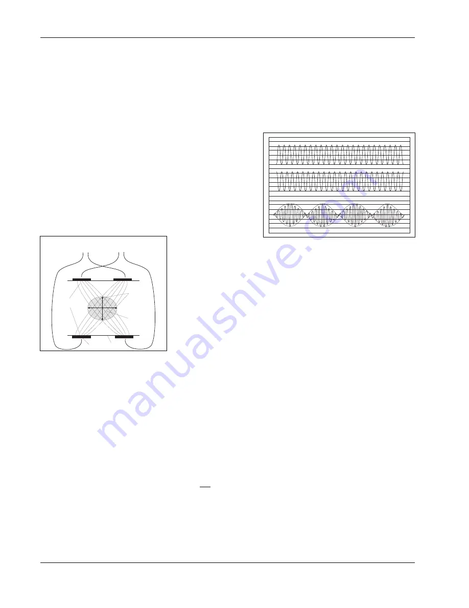 Dynatronics Dynatron 550 Plus Service Manual Download Page 78