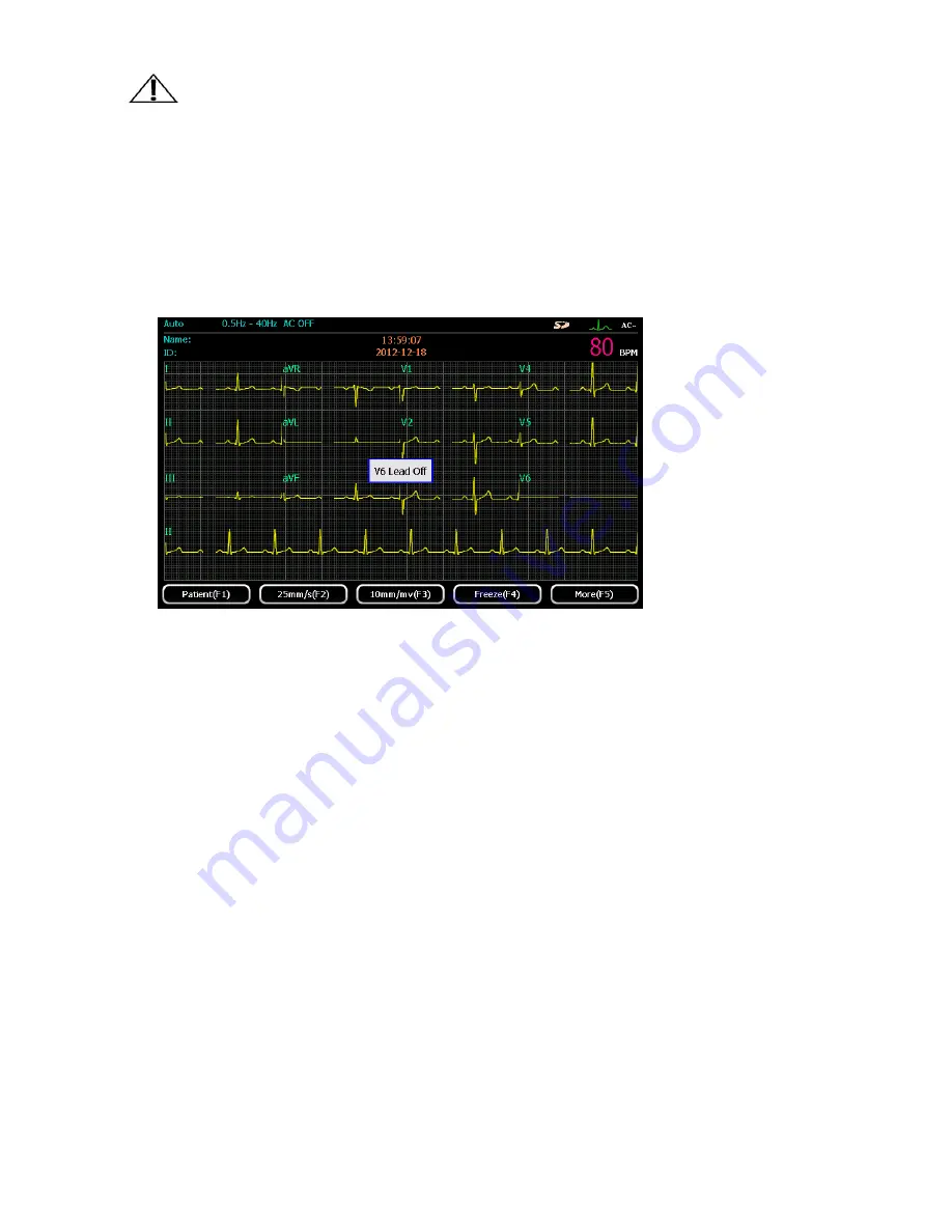 ECGMAC EM-301 User Manual Download Page 27