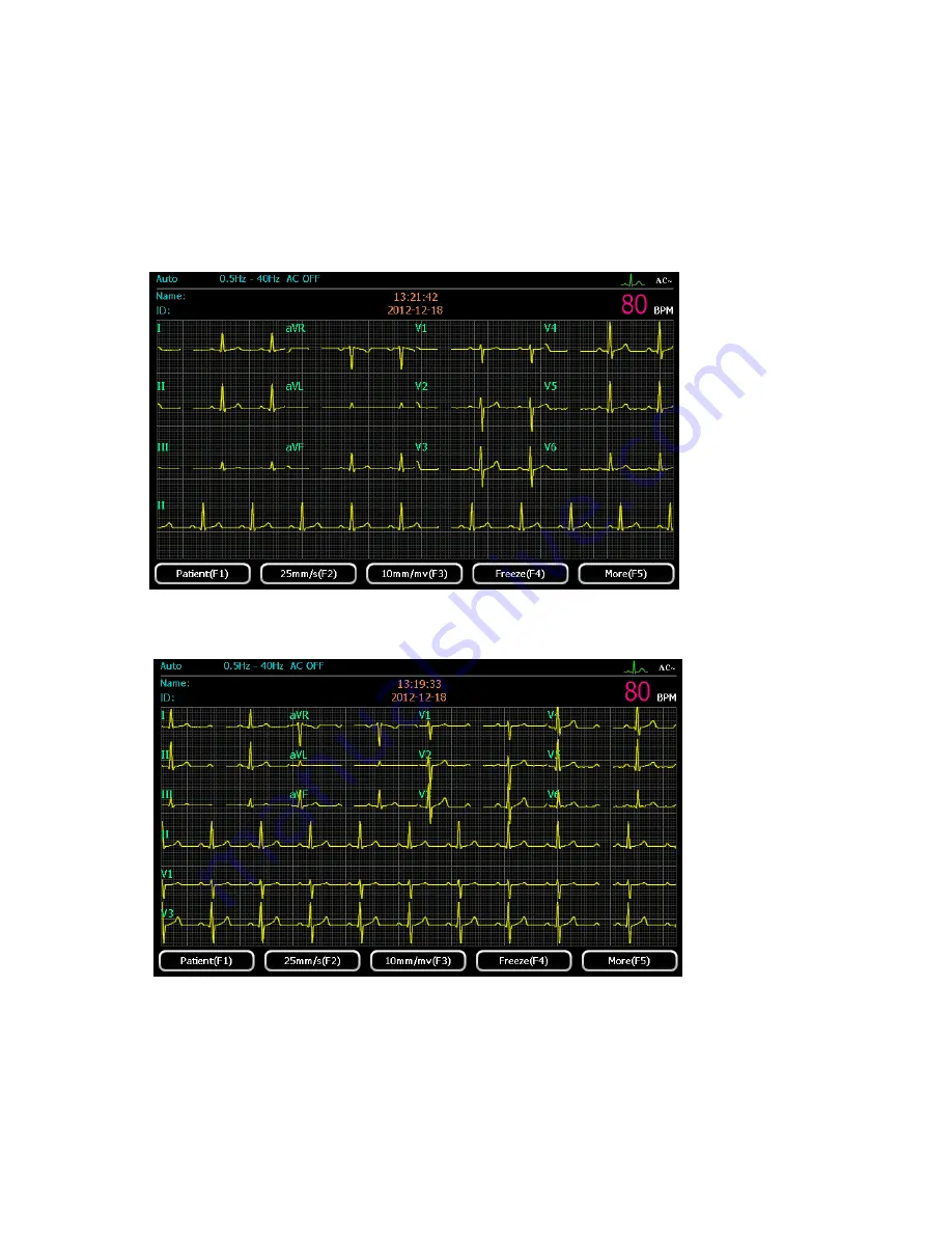 ECGMAC EM-301 User Manual Download Page 37