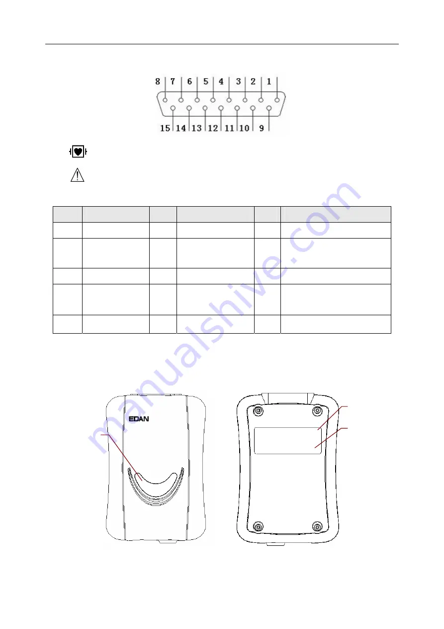 EDAN INSTRUMENTS VE-1010 User Manual Download Page 15