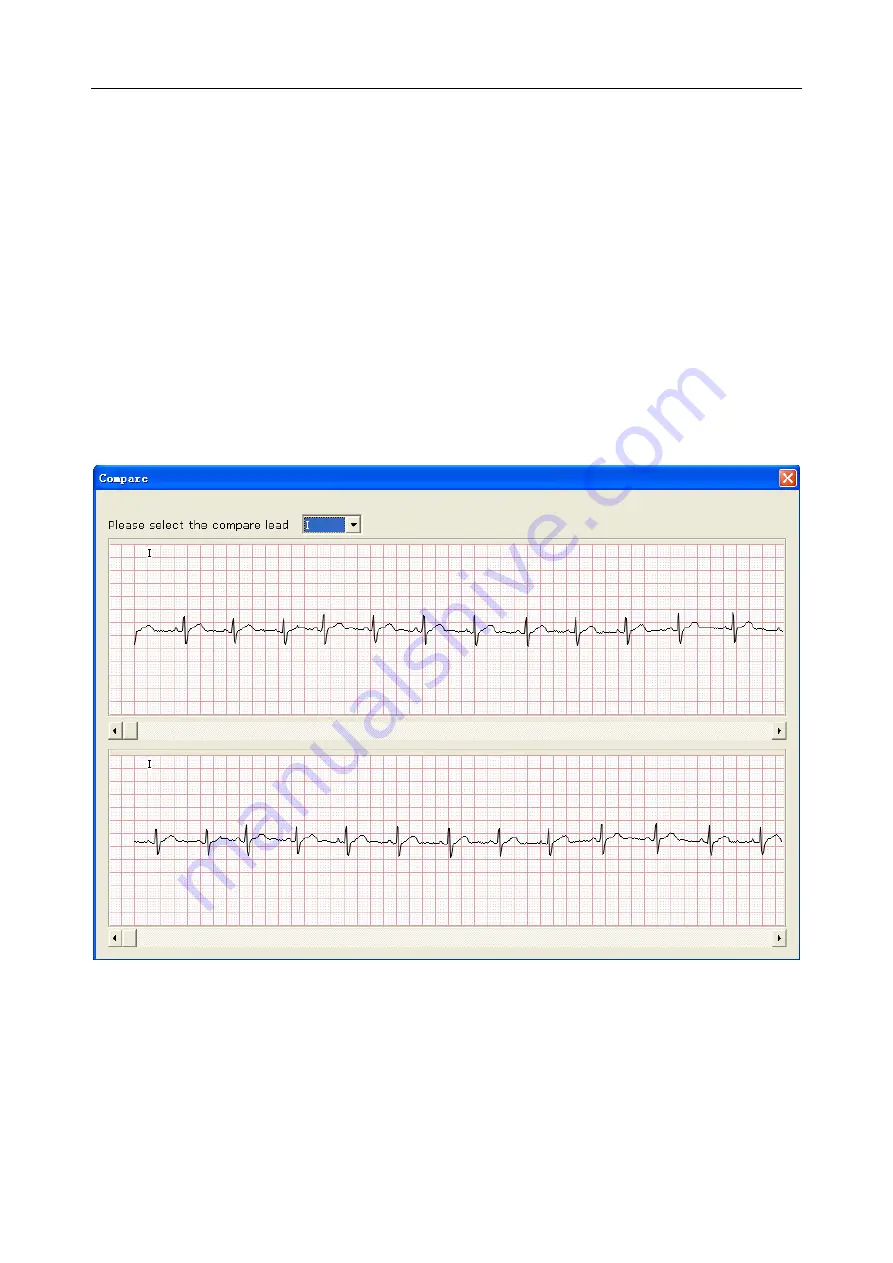 EDAN INSTRUMENTS VE-1010 User Manual Download Page 49