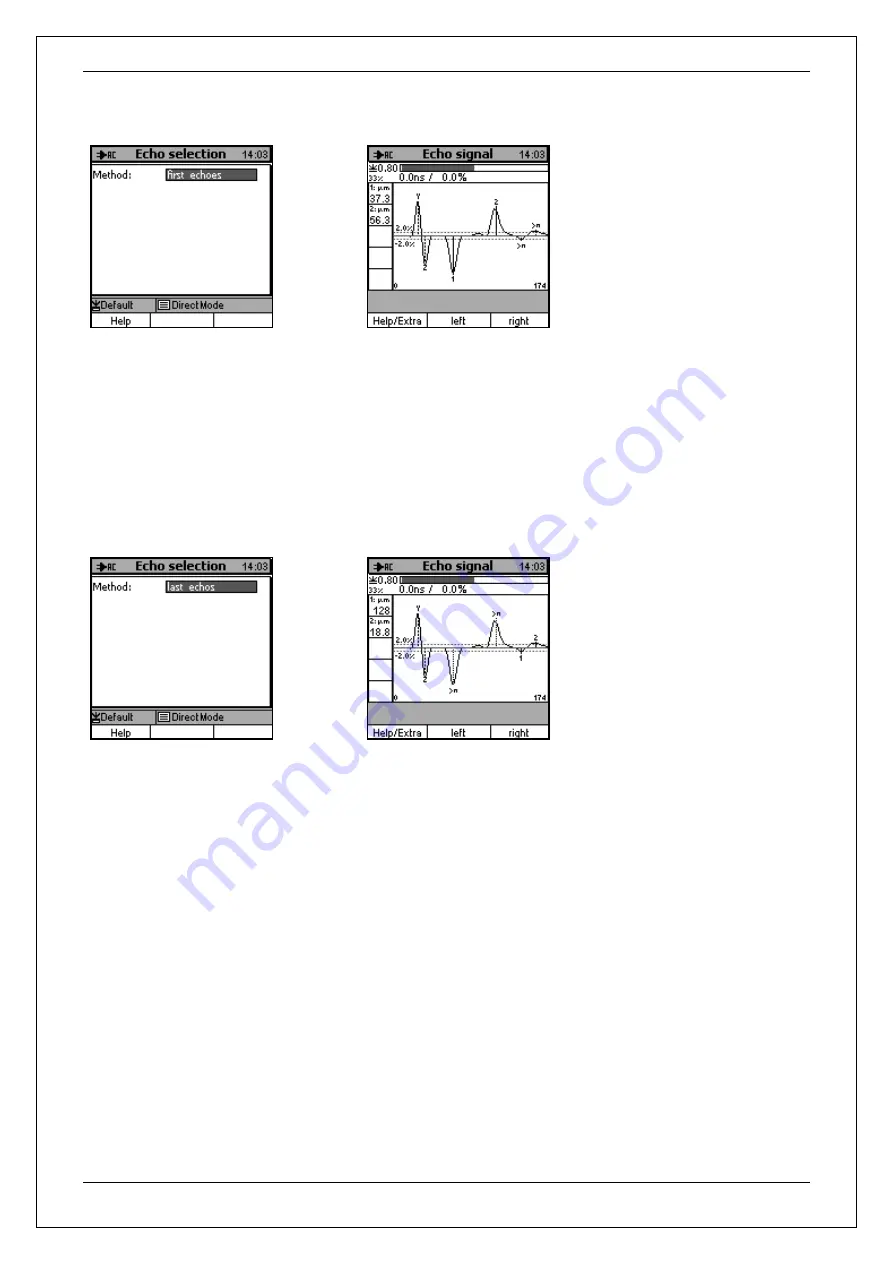 ElektroPhysik QuintSonic 7 Technical Manual And Operating Instructions Download Page 79