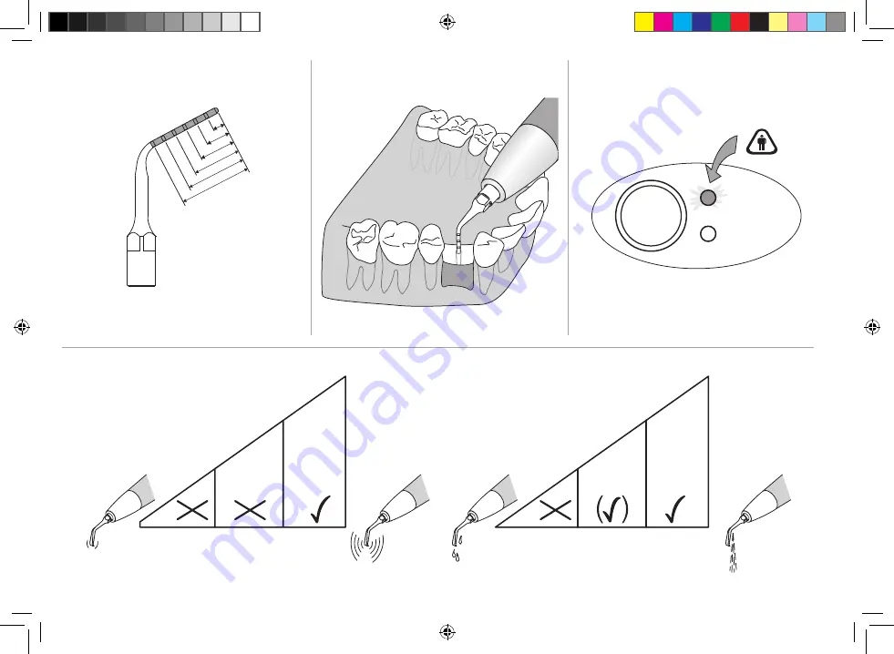 EMS Piezon Master Surgery Series Operation Instructions Manual Download Page 76