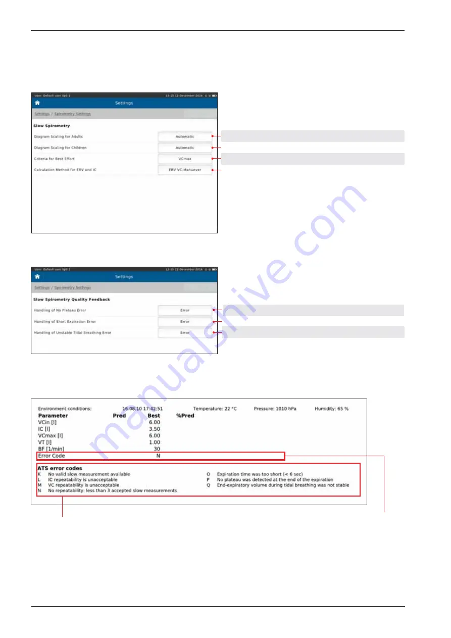 ERT SpiroSphere Instructions For Use Manual Download Page 58