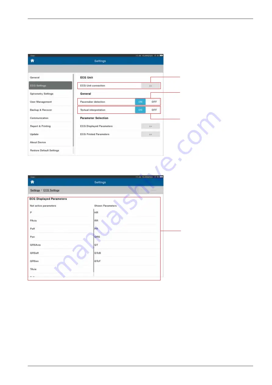 ERT SpiroSphere Instructions For Use Manual Download Page 75