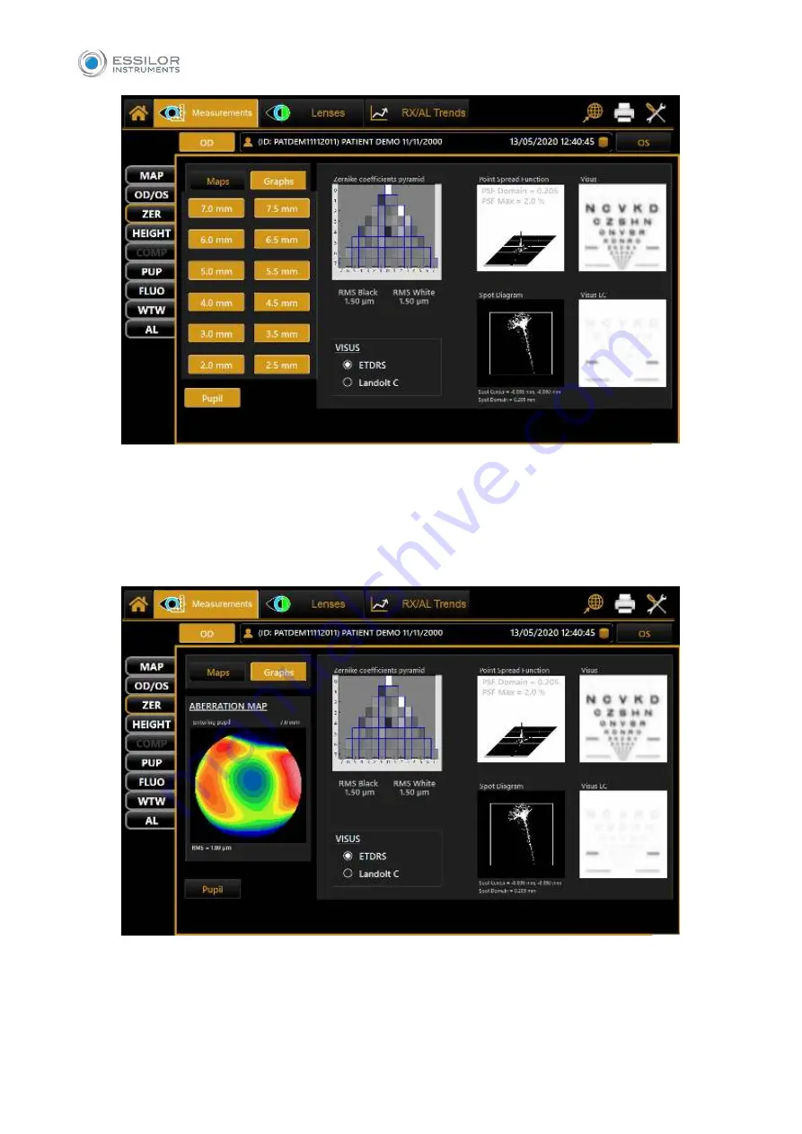 Essilor MYOPIA EXPERT 700 User Manual Download Page 79