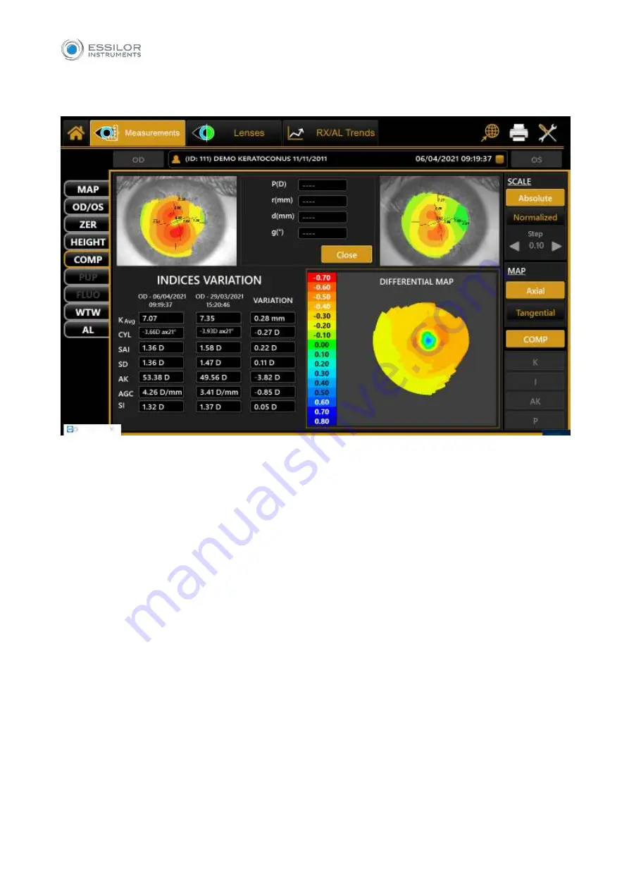 Essilor MYOPIA EXPERT 700 User Manual Download Page 85