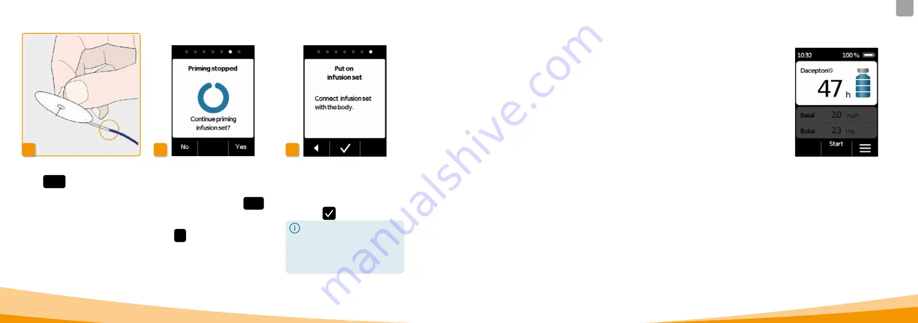 Ever Pharma D-mine Pump Instructions For Use Manual Download Page 29